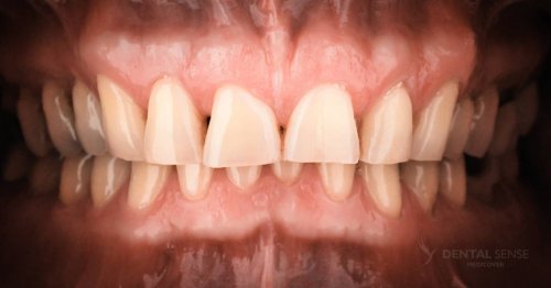 DSM_Metamorfoza_001_IMG_03