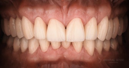 DSM_Metamorfoza_001_IMG_04