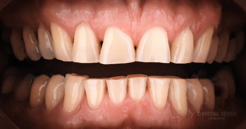 DSM_Metamorfoza_001_IMG_05