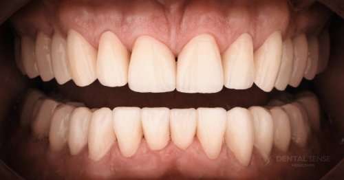 DSM_Metamorfoza_001_IMG_06