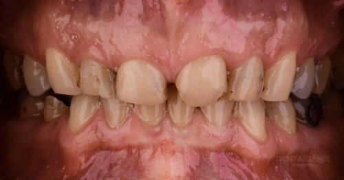 DSM_Metamorfoza_007_IMG_03