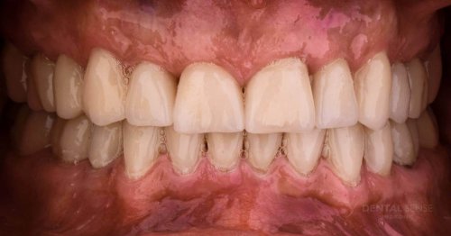 DSM_Metamorfoza_007_IMG_04