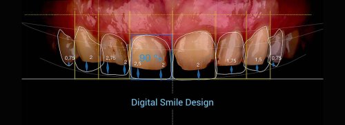 DSM_Metamorfoza_007_Parallax_05