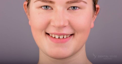 DSM_Metamorfoza_008_IMG_03