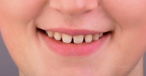 DSM_Metamorfoza_008_IMG_05