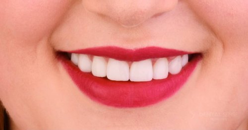 DSM_Metamorfoza_008_IMG_06