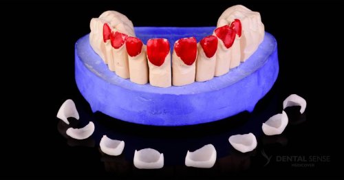 DSM_Metamorfoza_008_IMG_08