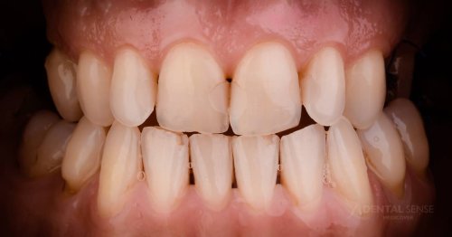 DSM_Metamorfoza_009_IMG_03