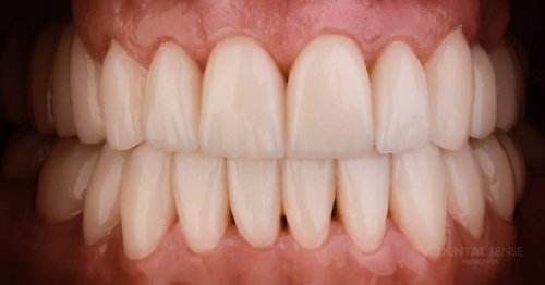 DSM_Metamorfoza_009_IMG_04