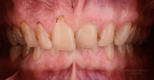 DSM_Metamorfoza_010_IMG_03