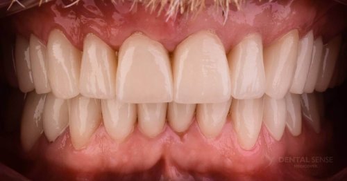 DSM_Metamorfoza_010_IMG_04