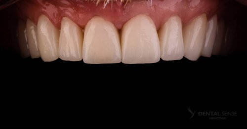 DSM_Metamorfoza_010_IMG_06