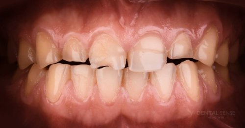 DSM_Metamorfoza_011_IMG_03