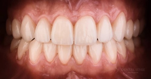 DSM_Metamorfoza_011_IMG_04