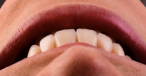 DSM_Metamorfoza_011_IMG_05