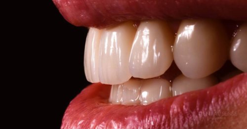 DSM_Metamorfoza_011_IMG_06