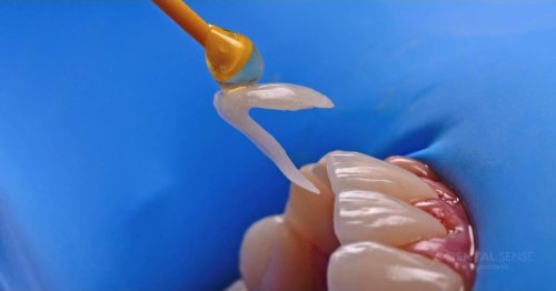 DSM_Metamorfoza_011_IMG_07