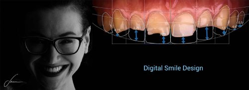 DSM_Metamorfoza_011_Parallax_01