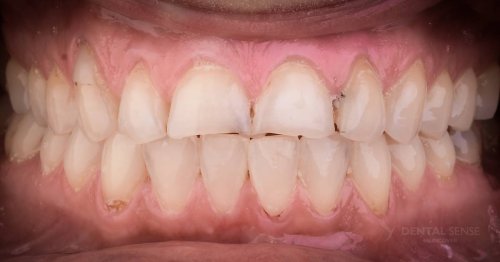 DSM_Metamorfoza_012_IMG_03