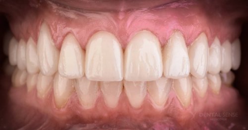 DSM_Metamorfoza_012_IMG_04