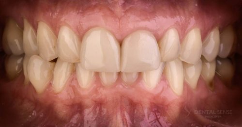 DSM_Metamorfoza_013_IMG_03