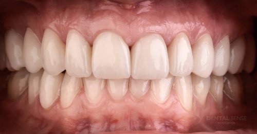 DSM_Metamorfoza_013_IMG_04