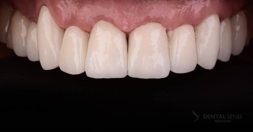 DSM_Metamorfoza_014_IMG_04