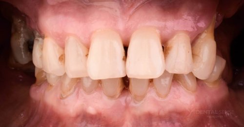 DSM_Metamorfoza_015_IMG_03