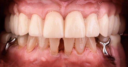 DSM_Metamorfoza_015_IMG_04