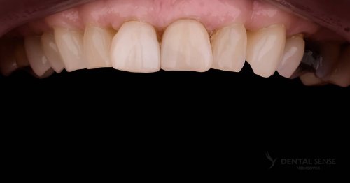 DSM_Metamorfoza_018_IMG_03