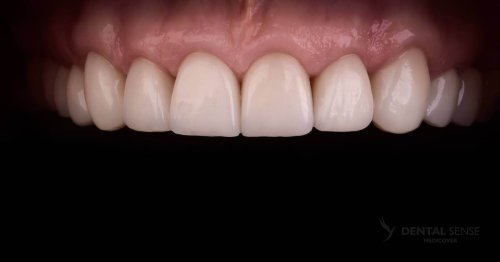 DSM_Metamorfoza_018_IMG_04