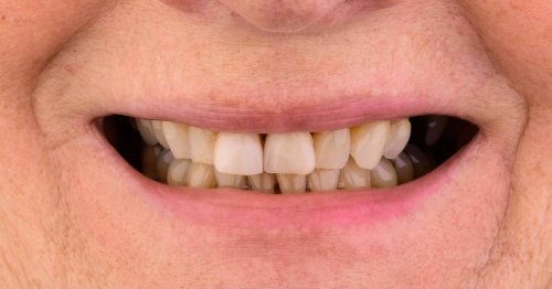 DSM_Metamorfoza_018_IMG_05