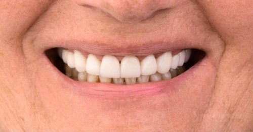 DSM_Metamorfoza_018_IMG_06