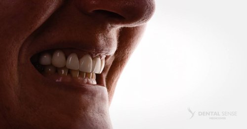 DSM_Metamorfoza_018_IMG_07