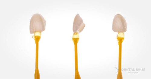 DSM_Metamorfoza_018_IMG_08