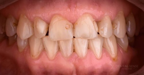 DSM_Metamorfoza_024_IMG_03