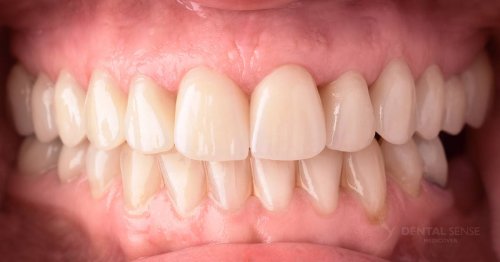 DSM_Metamorfoza_024_IMG_04