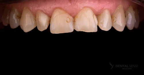 DSM_Metamorfoza_024_IMG_05