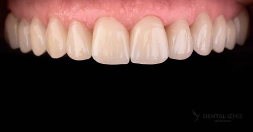 DSM_Metamorfoza_024_IMG_06