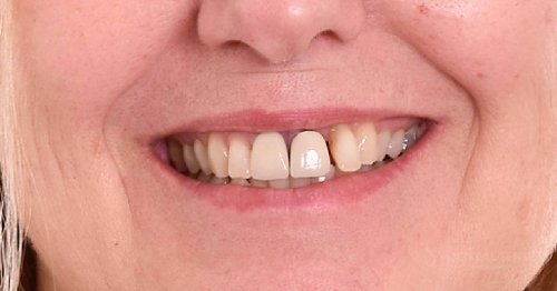 DSM_Metamorfoza_029_IMG_03