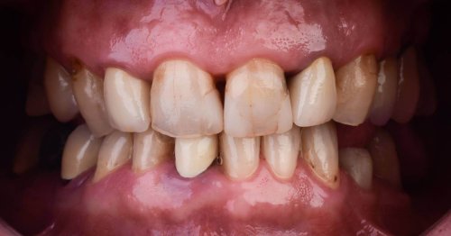 DSM_Metamorfoza_035_IMG_01