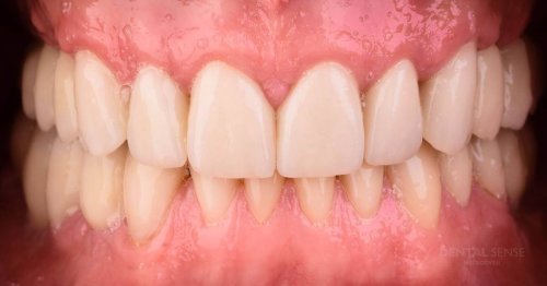 DSM_Metamorfoza_054_IMG_04