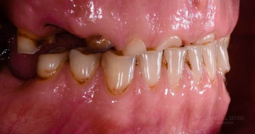 DSM_Metamorfoza_054_IMG_05