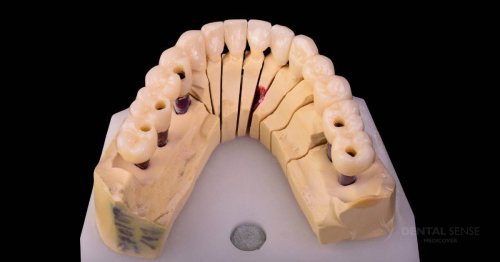 DSM_Metamorfoza_058_IMG_04