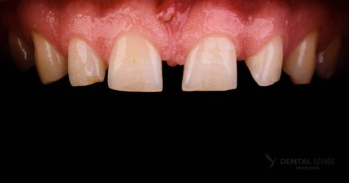 DSM_Metamorfoza_060_IMG_03