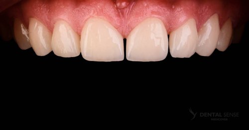 DSM_Metamorfoza_060_IMG_04