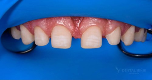 DSM_Metamorfoza_060_IMG_05