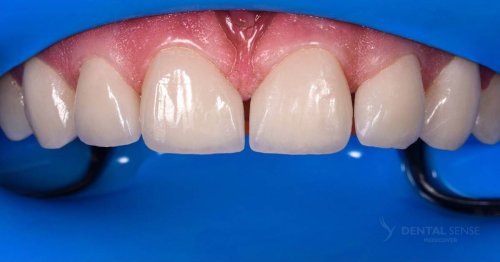 DSM_Metamorfoza_060_IMG_06