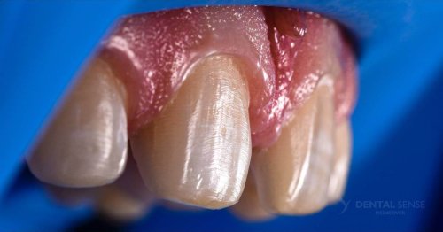 DSM_Metamorfoza_060_IMG_07