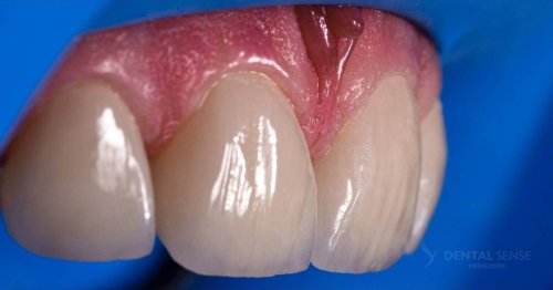 DSM_Metamorfoza_060_IMG_08